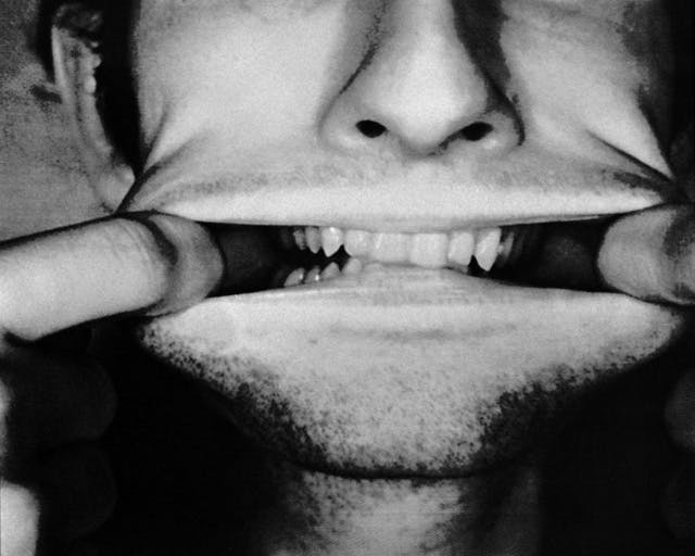 A black and white photocopy of the bottom half of a person’s face. This person puts index fingers in their mouth and pulls lips widely to both sides, showing their teeth. 